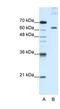 Pumilio RNA Binding Family Member 3 antibody, NBP1-57531, Novus Biologicals, Western Blot image 