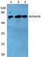Solute Carrier Family 6 Member 18 antibody, PA5-37221, Invitrogen Antibodies, Western Blot image 
