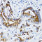 Matrix Metallopeptidase 7 antibody, LS-C331076, Lifespan Biosciences, Immunohistochemistry frozen image 