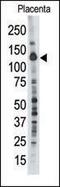 Protein Tyrosine Phosphatase Non-Receptor Type 21 antibody, PA5-15526, Invitrogen Antibodies, Western Blot image 