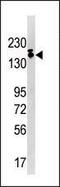 SET Domain Bifurcated Histone Lysine Methyltransferase 1 antibody, PA5-11207, Invitrogen Antibodies, Western Blot image 