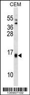 Serum Amyloid A4, Constitutive antibody, 58-909, ProSci, Western Blot image 