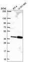 Tubulin Polyglutamylase Complex Subunit 2 antibody, HPA061753, Atlas Antibodies, Western Blot image 