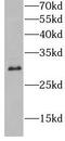 Major Histocompatibility Complex, Class II, DQ Beta 1 antibody, FNab10009, FineTest, Western Blot image 