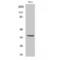 Immunoglobulin Heavy Constant Alpha 1 antibody, LS-C384054, Lifespan Biosciences, Western Blot image 