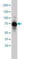 Alpha-adducin antibody, H00000118-M01, Novus Biologicals, Western Blot image 