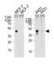 Calcitonin Receptor antibody, orb314159, Biorbyt, Western Blot image 