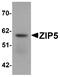 Zinc transporter ZIP5 antibody, A09389, Boster Biological Technology, Western Blot image 