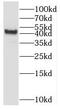 SET and MYND domain-containing protein 3 antibody, FNab08049, FineTest, Western Blot image 