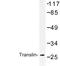 Translin antibody, LS-C176936, Lifespan Biosciences, Western Blot image 