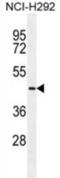 Transmembrane Serine Protease 11E antibody, abx025081, Abbexa, Western Blot image 