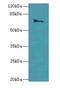 Calpain 6 antibody, LS-C398190, Lifespan Biosciences, Western Blot image 