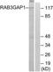 RAB3 GTPase Activating Protein Catalytic Subunit 1 antibody, TA315203, Origene, Western Blot image 