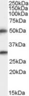 Transmembrane Serine Protease 5 antibody, NB100-896, Novus Biologicals, Western Blot image 