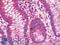 V-Set Domain Containing T Cell Activation Inhibitor 1 antibody, LS-C211329, Lifespan Biosciences, Immunohistochemistry frozen image 