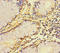 Zinc Finger DHHC-Type Containing 15 antibody, LS-C397735, Lifespan Biosciences, Immunohistochemistry paraffin image 