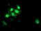 S100 Calcium Binding Protein P antibody, NBP2-01900, Novus Biologicals, Immunocytochemistry image 
