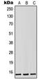 Luteinizing Hormone Beta Polypeptide antibody, LS-C352454, Lifespan Biosciences, Western Blot image 