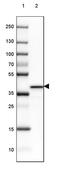 G Protein Subunit Alpha O1 antibody, PA5-59337, Invitrogen Antibodies, Western Blot image 