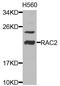 Rac Family Small GTPase 2 antibody, MBS127636, MyBioSource, Western Blot image 