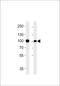 Villin 1 antibody, MBS9204820, MyBioSource, Western Blot image 