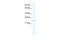 HIV-1 Tat Interactive Protein 2 antibody, 27-701, ProSci, Western Blot image 