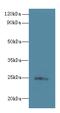 Transmembrane P24 Trafficking Protein 3 antibody, A61350-100, Epigentek, Western Blot image 