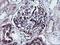 Schwannomin-interacting protein 1 antibody, MA5-25912, Invitrogen Antibodies, Immunohistochemistry paraffin image 