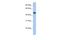 Adipocyte Plasma Membrane Associated Protein antibody, A08954, Boster Biological Technology, Western Blot image 