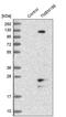 Transmembrane Protein 186 antibody, PA5-53759, Invitrogen Antibodies, Western Blot image 