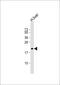 Rhophilin Associated Tail Protein 1 antibody, M10524, Boster Biological Technology, Western Blot image 