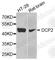 Decapping MRNA 2 antibody, A8282, ABclonal Technology, Western Blot image 