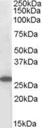 Suppressor Of Cytokine Signaling 3 antibody, PA5-17934, Invitrogen Antibodies, Western Blot image 