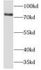 T-Box 3 antibody, FNab08540, FineTest, Western Blot image 