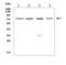 Protein Phosphatase, Mg2+/Mn2+ Dependent 1D antibody, A01576-1, Boster Biological Technology, Western Blot image 