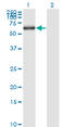 Karyopherin Subunit Alpha 1 antibody, LS-B6105, Lifespan Biosciences, Western Blot image 