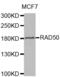 RAD50 Double Strand Break Repair Protein antibody, abx002219, Abbexa, Western Blot image 