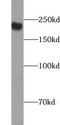 Transient Receptor Potential Cation Channel Subfamily M Member 7 antibody, FNab10501, FineTest, Western Blot image 