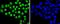 X-Ray Repair Cross Complementing 5 antibody, NBP2-67583, Novus Biologicals, Immunocytochemistry image 