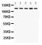 Clock Circadian Regulator antibody, RP1082, Boster Biological Technology, Western Blot image 