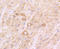 Interferon Alpha And Beta Receptor Subunit 1 antibody, STJ112809, St John