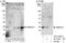 Transmembrane protein 127 antibody, A303-450A, Bethyl Labs, Western Blot image 