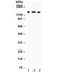 ATP Binding Cassette Subfamily B Member 11 antibody, R31844, NSJ Bioreagents, Western Blot image 