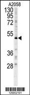 Forkhead Box C2 antibody, 62-034, ProSci, Western Blot image 