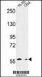 MICAL Like 2 antibody, 61-703, ProSci, Western Blot image 