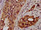 NAD(P) Dependent Steroid Dehydrogenase-Like antibody, LS-C670280, Lifespan Biosciences, Immunohistochemistry paraffin image 
