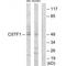 Cleavage Stimulation Factor Subunit 1 antibody, A11478, Boster Biological Technology, Western Blot image 