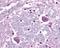 Corticotropin Releasing Hormone Receptor 1 antibody, NLS1779, Novus Biologicals, Immunohistochemistry paraffin image 