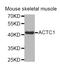 Actin Alpha Cardiac Muscle 1 antibody, STJ28590, St John
