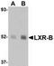 Nuclear Receptor Subfamily 1 Group H Member 2 antibody, TA306912, Origene, Western Blot image 